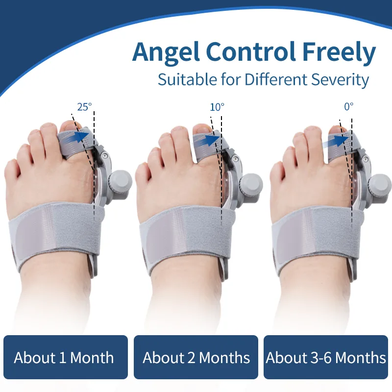 Premium Adjustable Bunion Corrector / Big Toe Straightener – 1 Pair - Image 5